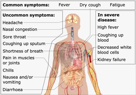 Symptoms of Coronavirus disease COVID – 19 VIT Bhopal  - Best University in Central India -  image-4